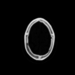 CT scan showing bone contrast