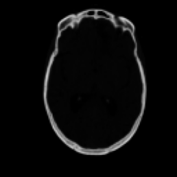 CT sample 2