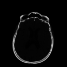 CT sample 3
