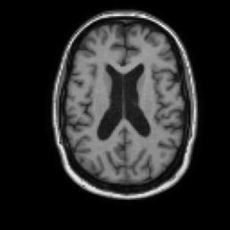 MRI sample 2