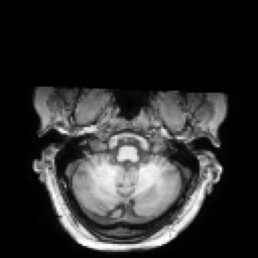 MRI sample 3