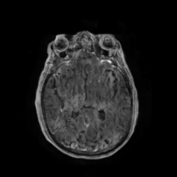 Generated MRI